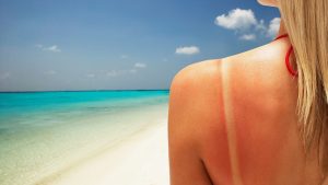 Can You Get Skin Cancer From Just One Sunburn?